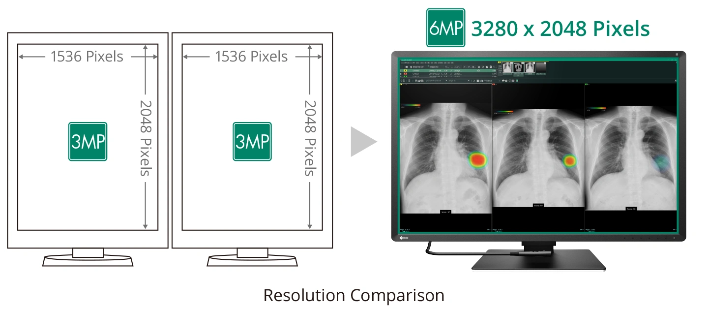 Multi-Modality Capability with 6MP Resolution